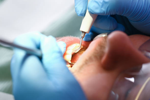 Best Emergency Dentist for Special Needs Patients in Paxton, IL