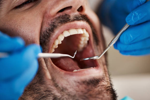Best Emergency Dentist for Knocked-Out Tooth in Paxton, IL