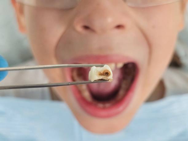 Best Weekend Emergency Dentist in Paxton, IL