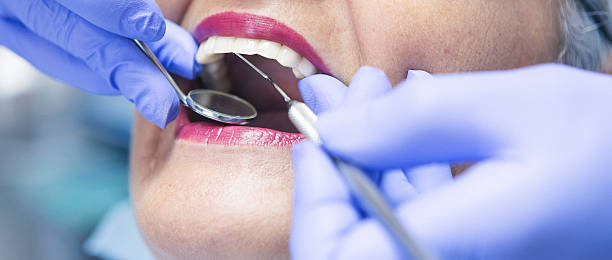 Best Broken or Cracked Tooth Emergency Dentist in Paxton, IL
